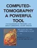 Computed-Tomography a Powerful Tool for Diagnosis of Pediatric and Adult Congenital Heart Disease - M. D. Facc Jami G. Shakibi