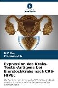 Expression des Krebs-Testis-Antigens bei Eierstockkrebs nach CRS-HIPEC - M D Ray, Premanand N