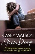 Skin Deep - Casey Watson